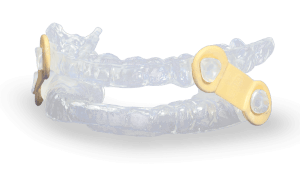 Yellow dentures