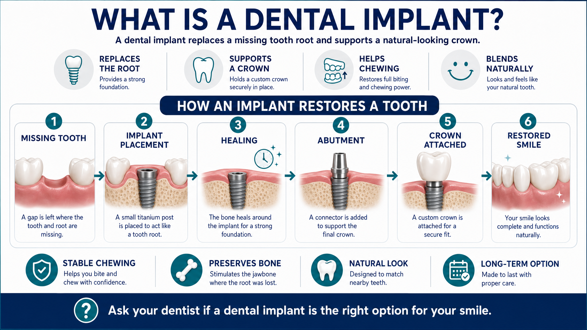 What is a dental implant infographic