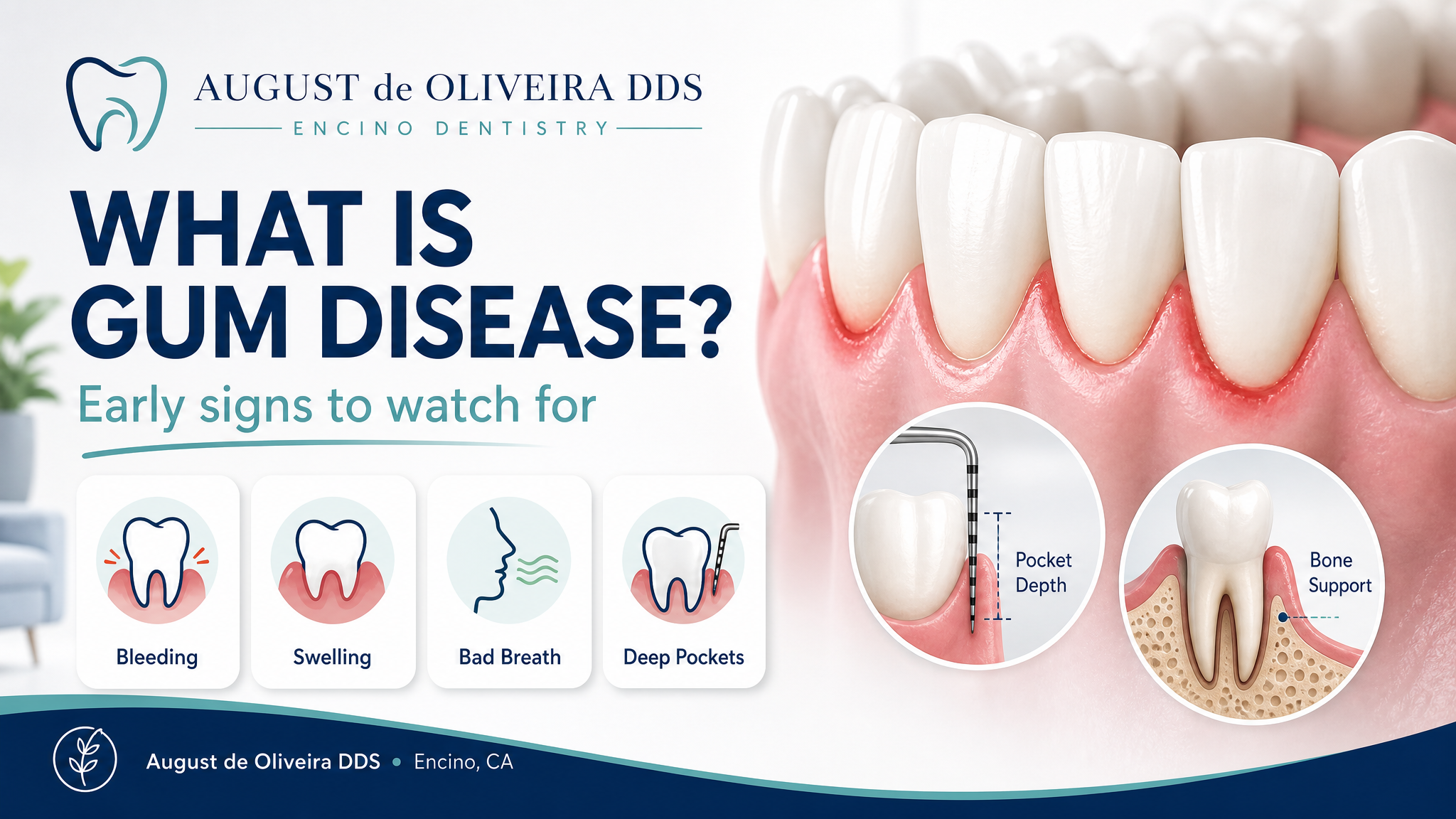 What Is Gum Disease? Early Signs to Watch For