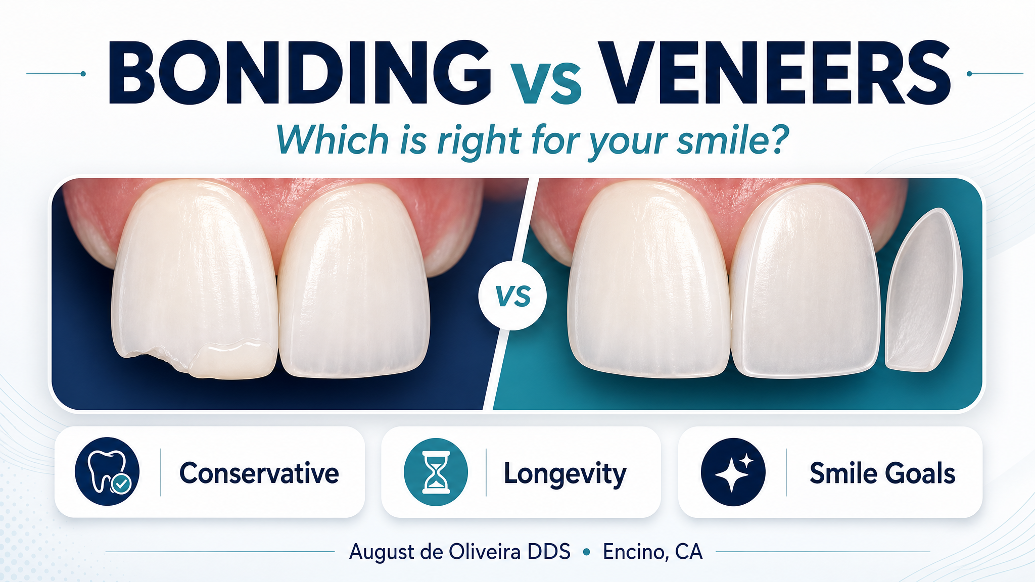 Dental Bonding vs Veneers: Which Is Right for You?