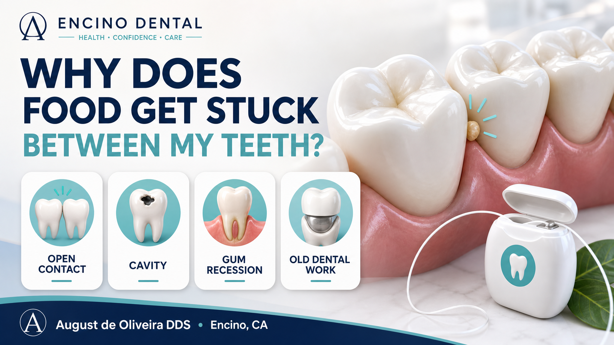 Why Does Food Get Stuck Between My Teeth?